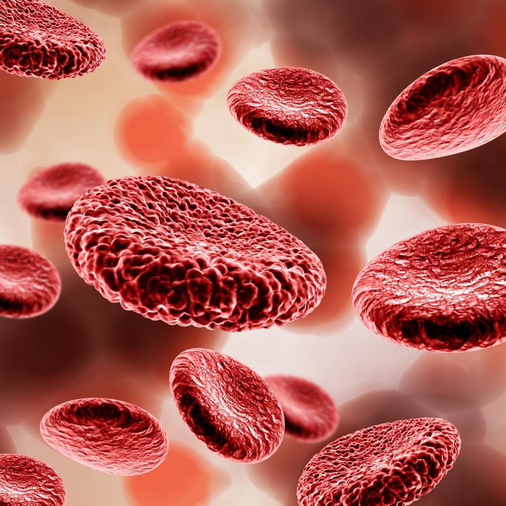 You are currently viewing Sickle cell disease – Symptoms and causes